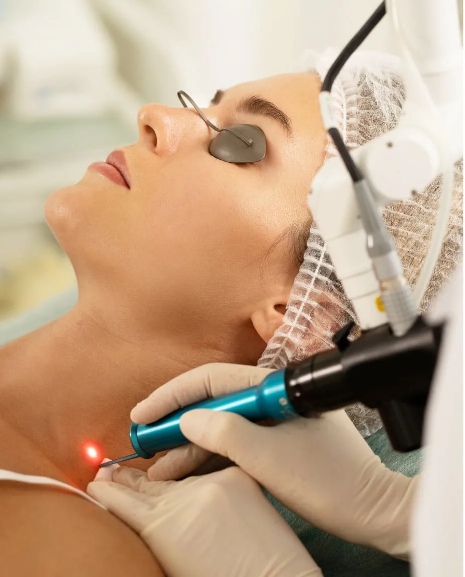 Laser Pigmentation Removal in JVC at Vedara Care