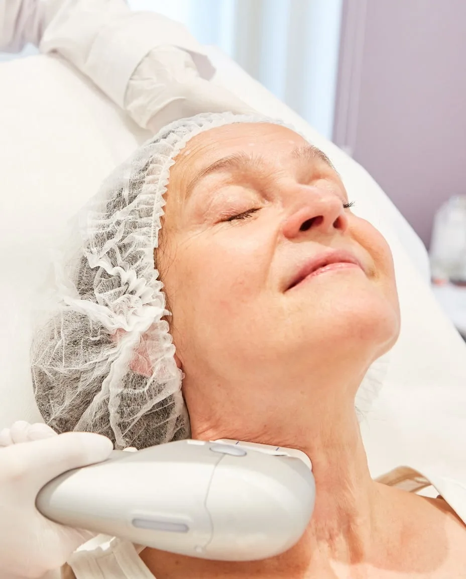 How skin tightening treatment works